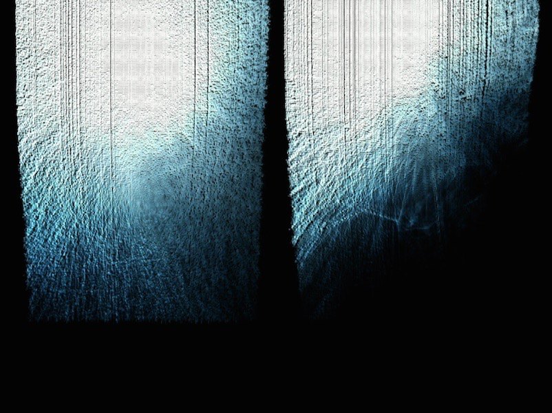 Retina